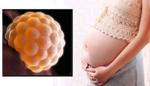 Những điều cần biết về thai trứng