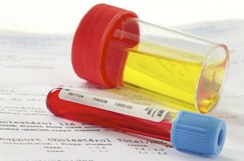 Ý nghĩa của các xét nghiệm đánh giá chức năng thận