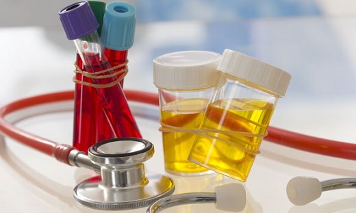 Xét nghiệm định lượng protein niệu?