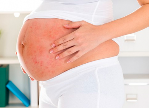 Mẹ bầu bị thủy đậu có giữ được thai không ?