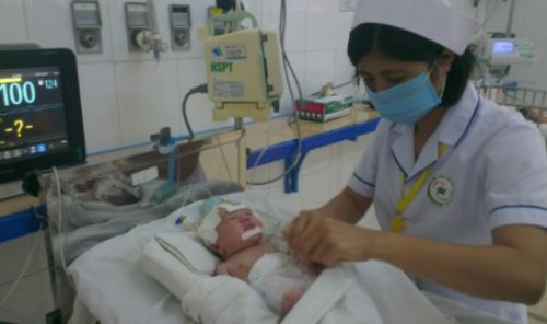 Viêm phúc mạc do phân su và hội chứng nút phân su