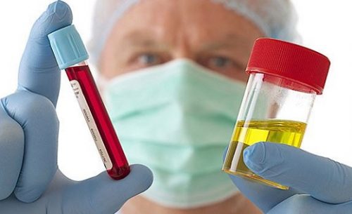 Xét nghiệm Beta HCG bao nhiêu là có thai?