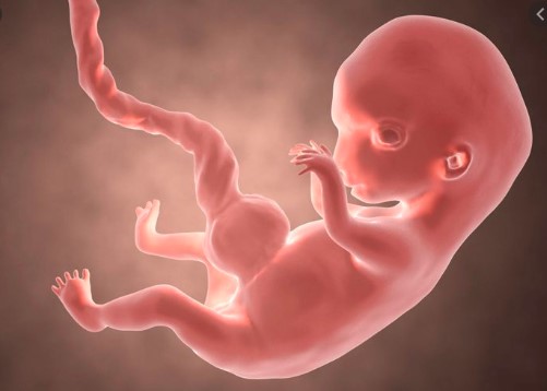 Bất thường ở thai nhi – Dây rốn 1 động mạch