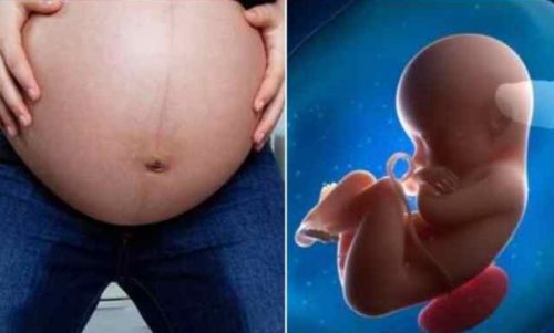 Nguy cơ tiềm ẩn khi rỉ nước ối và chảy dịch âm đạo trong thai kỳ