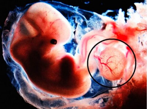 Bất thường túi noãn hoàng mẹ bầu cần biết