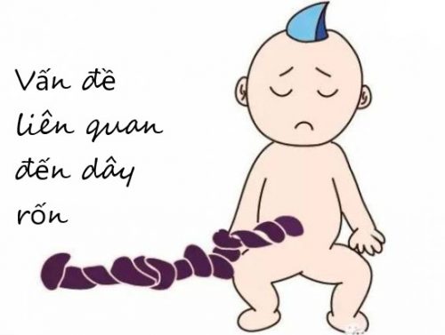 Những vấn đề liên quan đến dây rốn mẹ bầu cần lưu ý