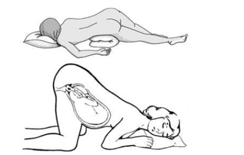 xử trí sa dây rốn