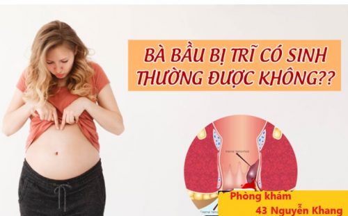 Bà bầu bị trĩ có sinh thường được không ?