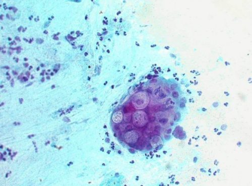 Những lưu ý khi thực hiện xét nghiệm Chlamydia