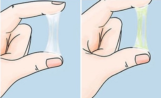 Những thay đổi của khí hư mà chị em cần quan tâm