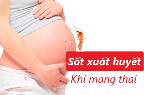 Sốt xuất huyết ở phụ nữ mang thai