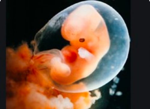 Túi ối nhỏ hơn tuổi thai có nguy hiểm không ?