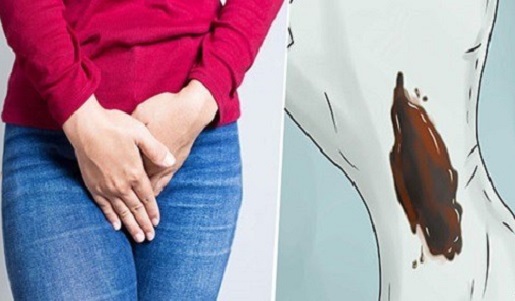 Các bệnh phụ khoa gây khí hư màu nâu bạn cần biết