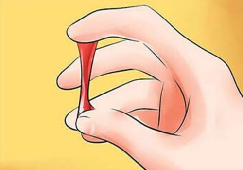 Ra khí hư lẫn máu sau khi quan hệ có sao không?