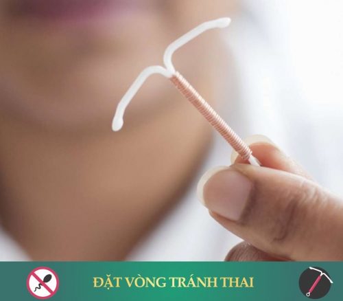 Đặt vòng tránh thai – Phương pháp tránh thai hiện đại hiệu quả