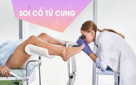 Tổng hợp những câu hỏi liên quan tới soi cổ tử cung