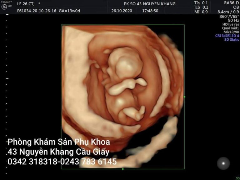 Những bất ngờ thú vị về thai nhi có thể mẹ chưa biết