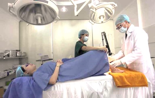 Quy trình đốt viêm lộ tuyến bằng sóng cao tần?