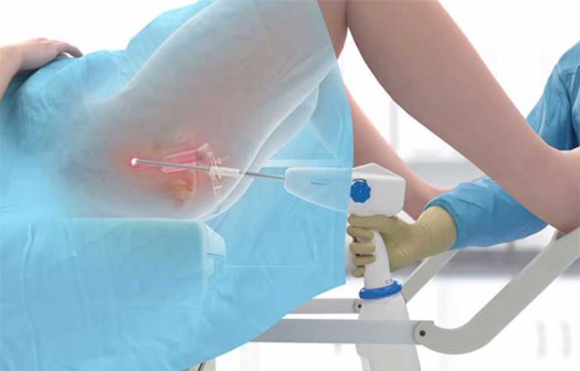 Sau áp lạnh cổ tử cung cần chú ý điều gì?
