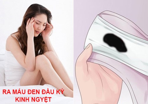 Màu sắc kinh nguyệt cảnh báo sức khỏe của bạn như thế nào?