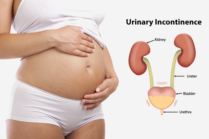 nhiễm trùng đường tiết niệu