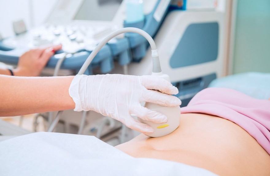 6 biện pháp phòng ngừa u nang buồng trứng