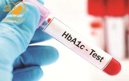 Những ưu điểm của xét nghiệm HbA1c so với xét nghiệm glucose máu