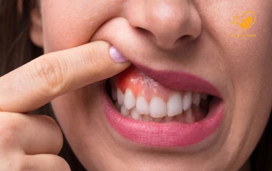 Những vấn đề răng miệng thường gặp ở phụ nữ mang thai