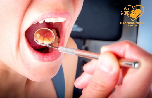 Cách phòng ngừa viêm lợi cho phụ nữ mang thai