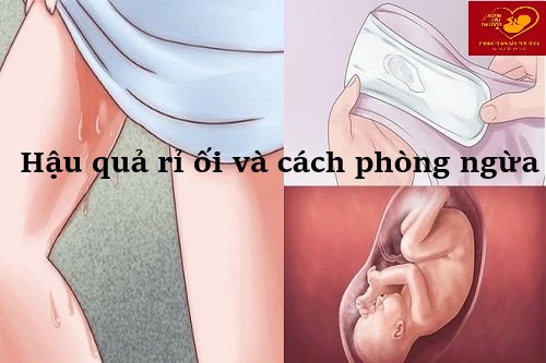 Hậu quả và cách phòng ngừa rỉ ối trong mang thai