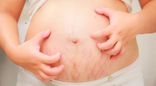 Bị ngứa khi mang thai có nguy hiểm không?