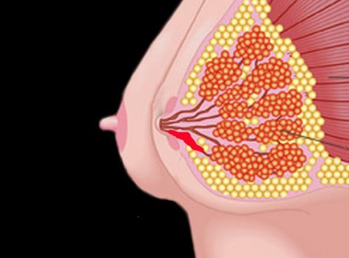 Tắc tia sữa sau sinh-những điều mẹ cần biết