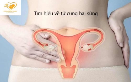 Một số điều cần biết về tử cung hai sừng ?