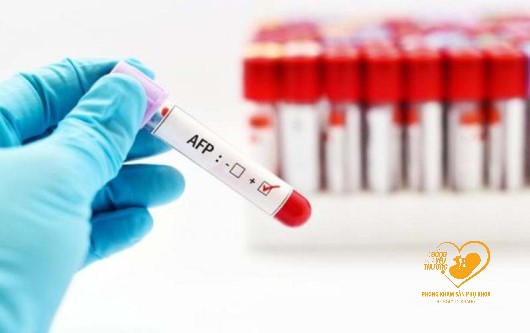 Xét nghiệm AFP là gì?