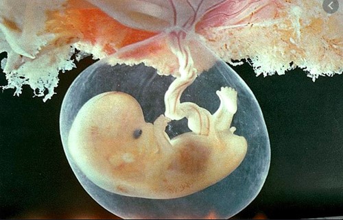 Thiểu ối mẹ bầu nên làm gì?