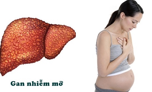 Gan nhiễm mỡ khi mang thai phải làm sao?
