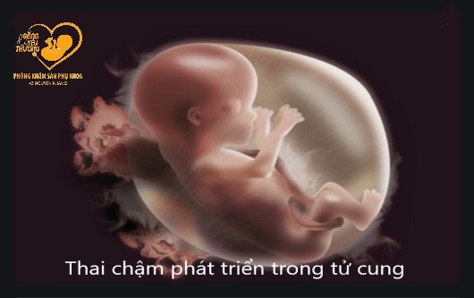 Những yếu tố nguy cơ gây thai chậm phát triển trong tử cung