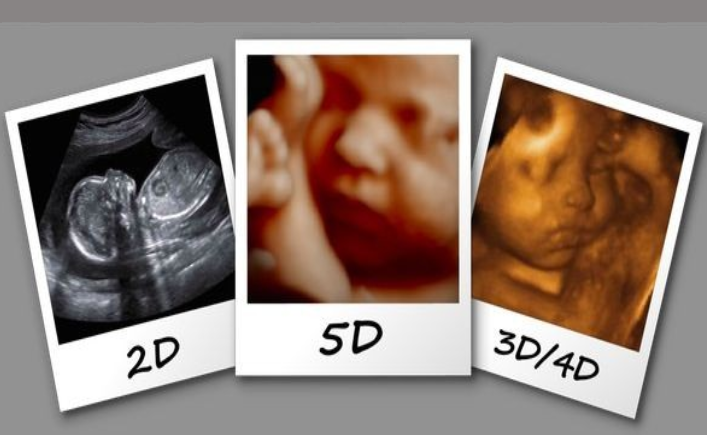 Sự khác biệt giữa siêu âm 2D và 3D