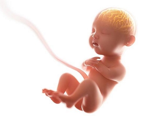 Thế nào là dây rốn một động mạch?