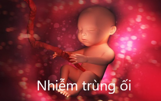 Nhiễm trùng ối – tình trạng nguy hiểm tới mẹ bầu và thai nhi