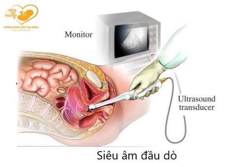 Siêu âm đầu dò và những điều bạn cần biết
