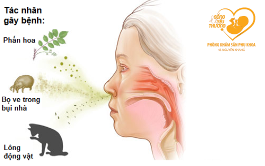 viêm mũi dị ứng khi mang thai