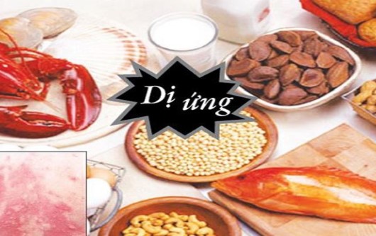 Bà bầu dị ứng xử trí thế nào