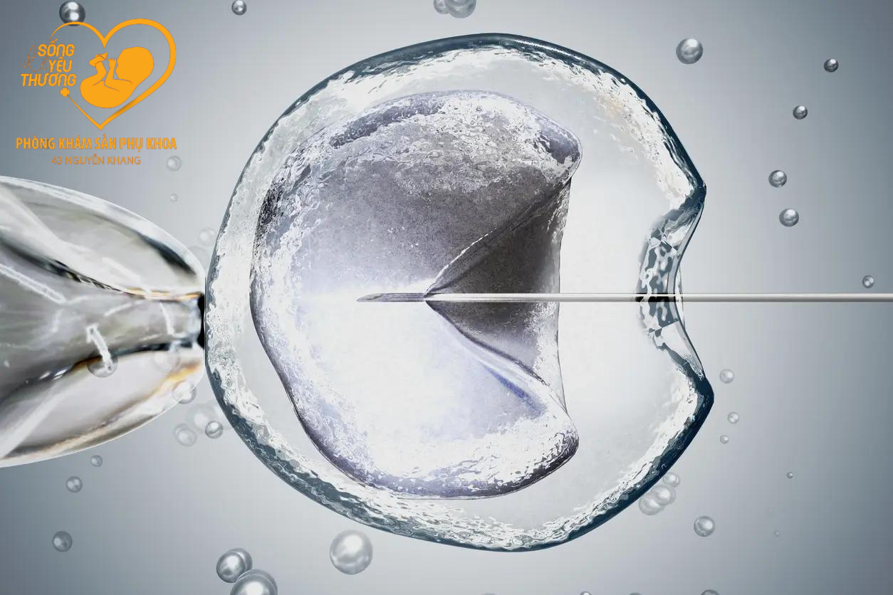 nguyên nhân khiến IVF thất bại 