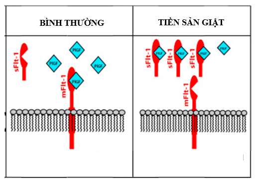 sFlt1 trong sàng lọc tiền sản giật