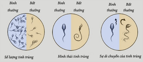 xét nghiệm tinh dịch đồ
