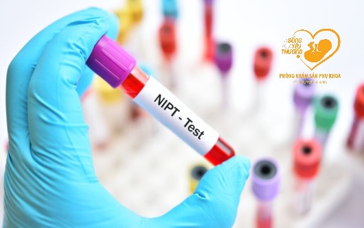 Xét nghiệm NIPT