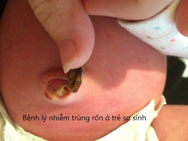 bệnh lý thường gặp ở trẻ