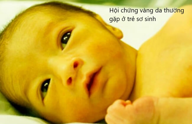 bệnh lý thường gặp ở trẻ