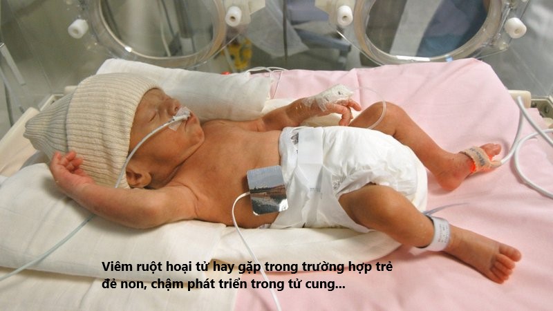 bệnh lý thường gặp ở trẻ